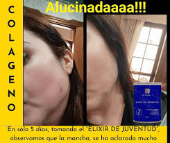 images (5)